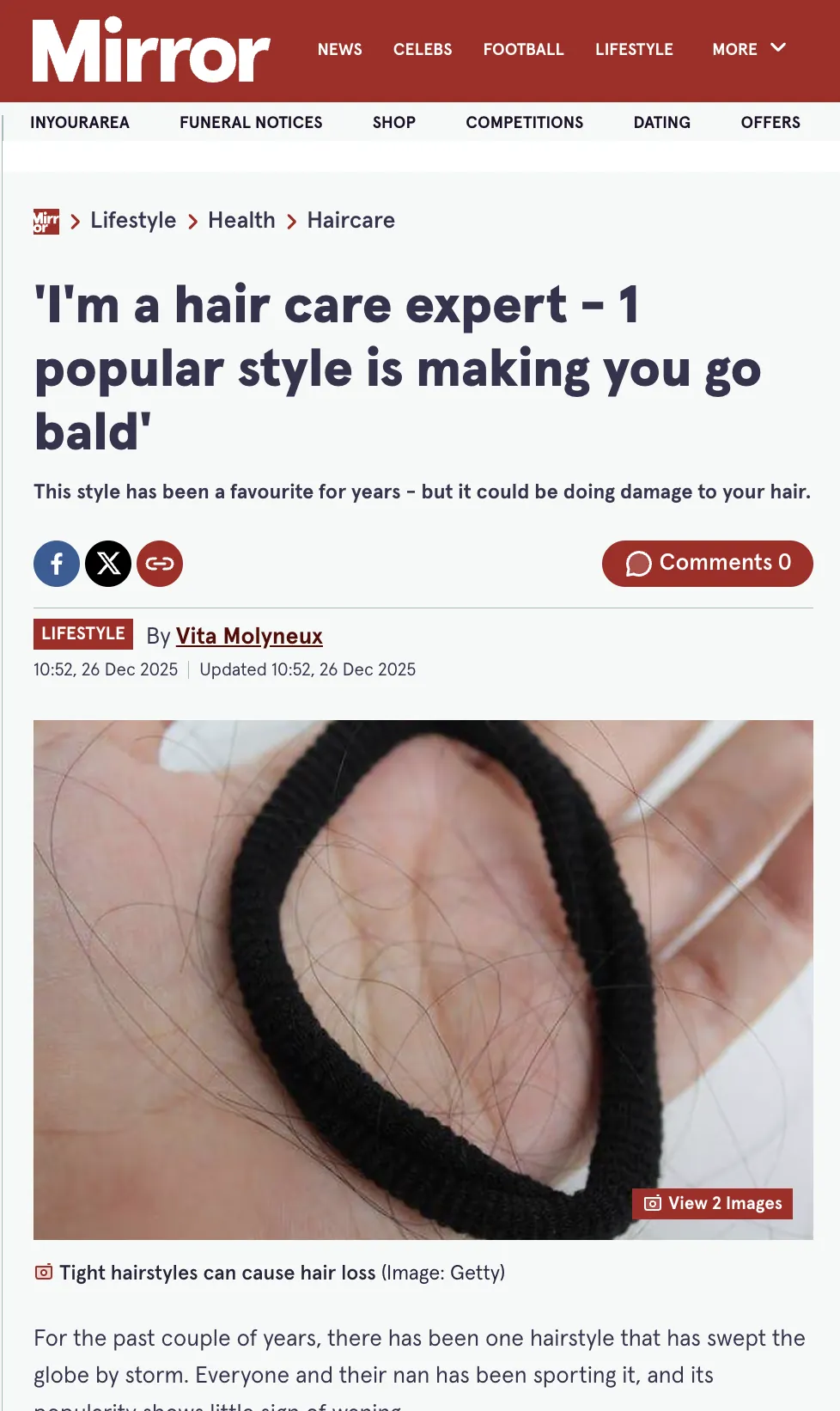 Daily Mirror coverage: I'm a hair care expert: one popular style is making you go bald